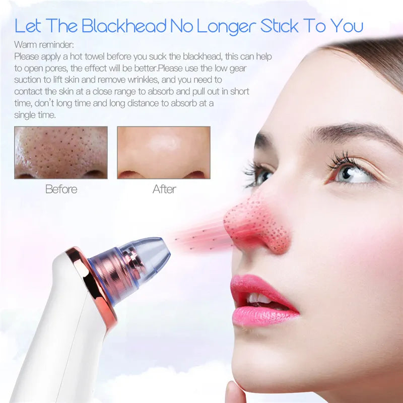 Microdermabrasion Kit